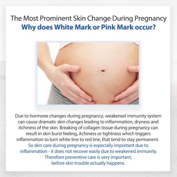 TnTn Mom's Expectant Mother’s Belly Cream