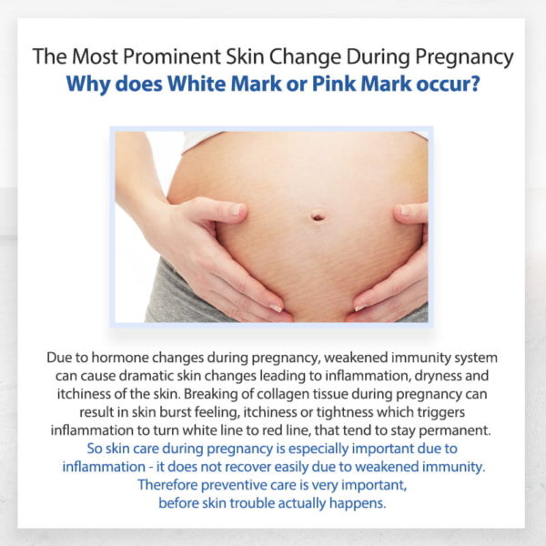 TnTn Mom's Expectant Mother's Belly Mask
